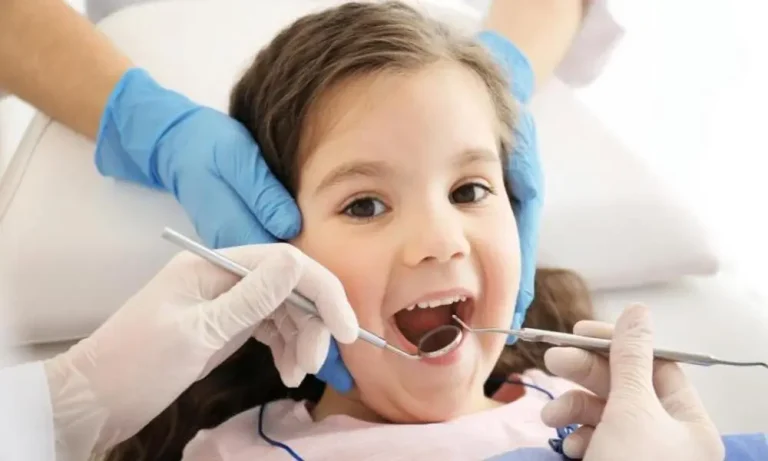 اسنان مسوسة للاطفال