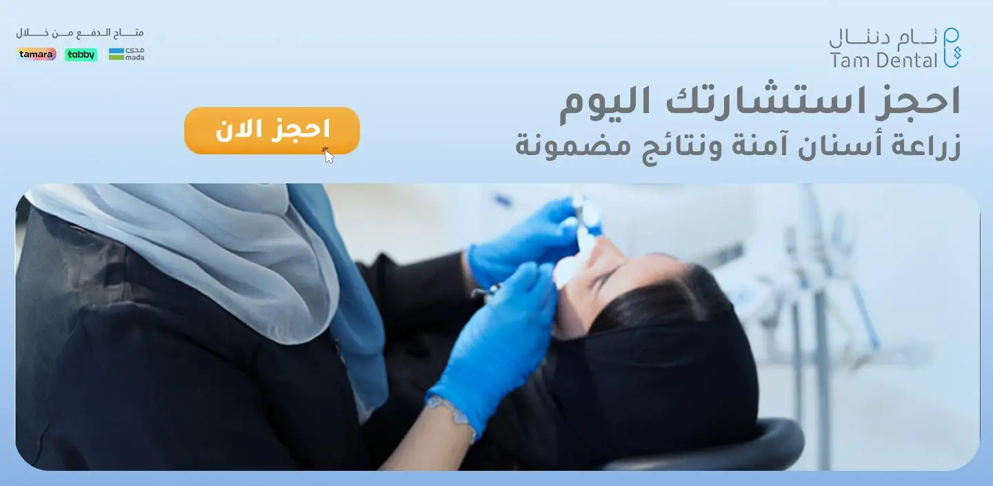 كل ماتحتاج معرفتة عن كيفية زراعة الاسنان بالليزر حجز عيادة زراعة الاسنان