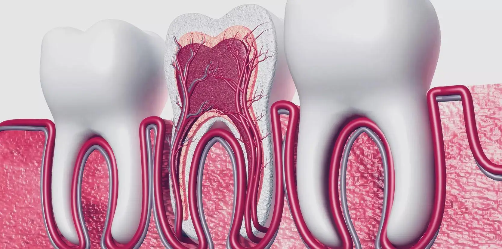 حشو السن بدون سحب عصب