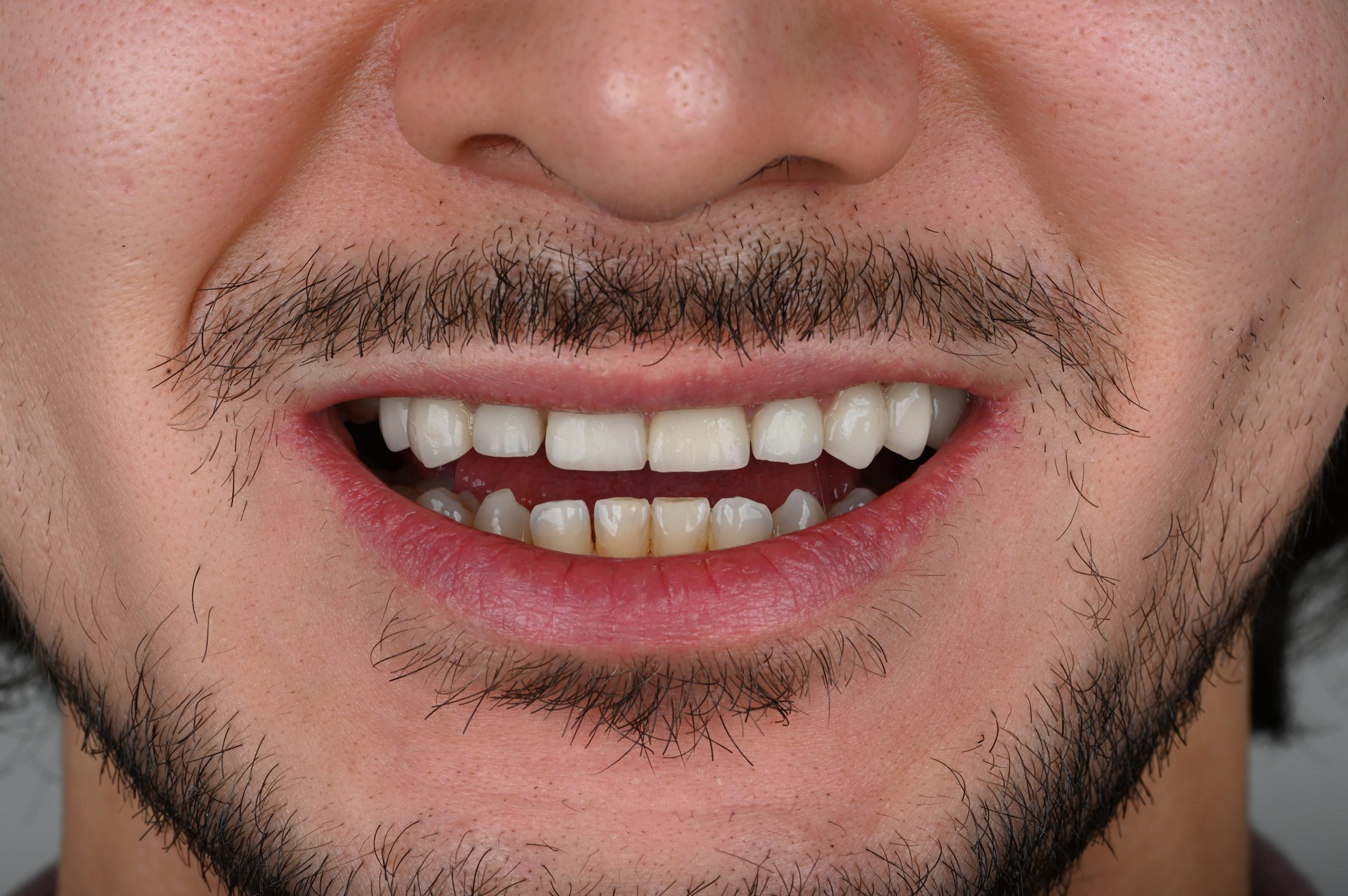 Before Image