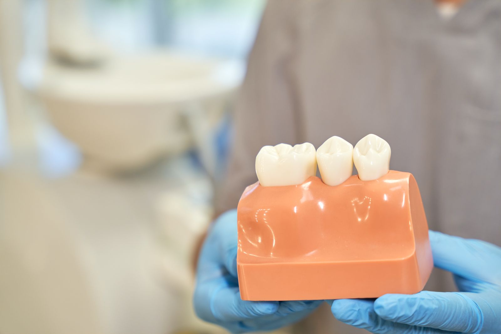 Dental Crowns in Front Teeth: What Expats in Jeddah Need to Know Dental Crowns