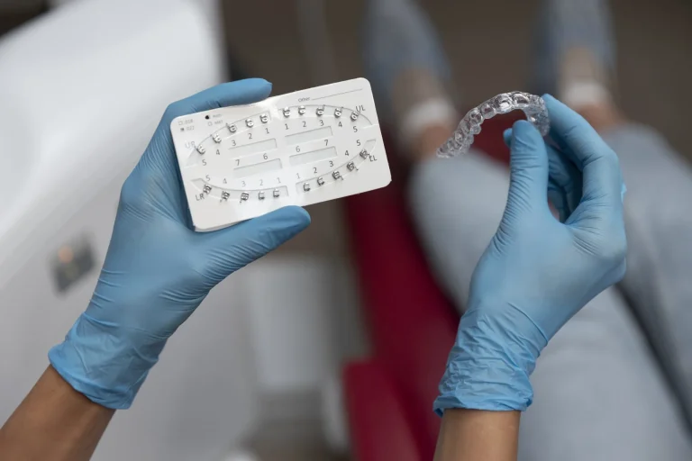 Clear Aligners vs Braces: The Best Solution in Saudi Arabia