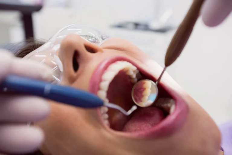 Gum Treatment in Jeddah: Restore Your Smile and Protect Your Health