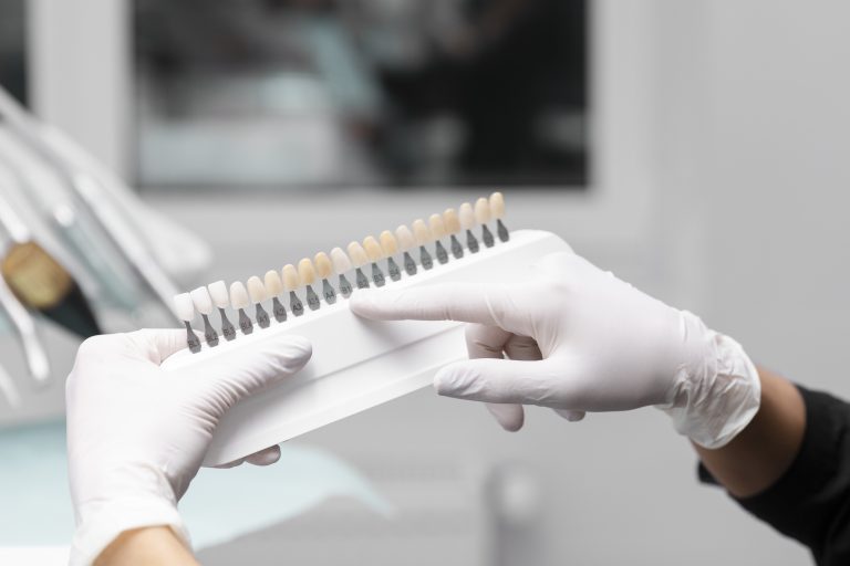 Transform Your Smile with Direct  Veneers in Jeddah
