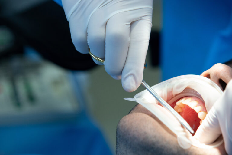Dentist placing a tooth-coloured filling during a restorative dental treatment