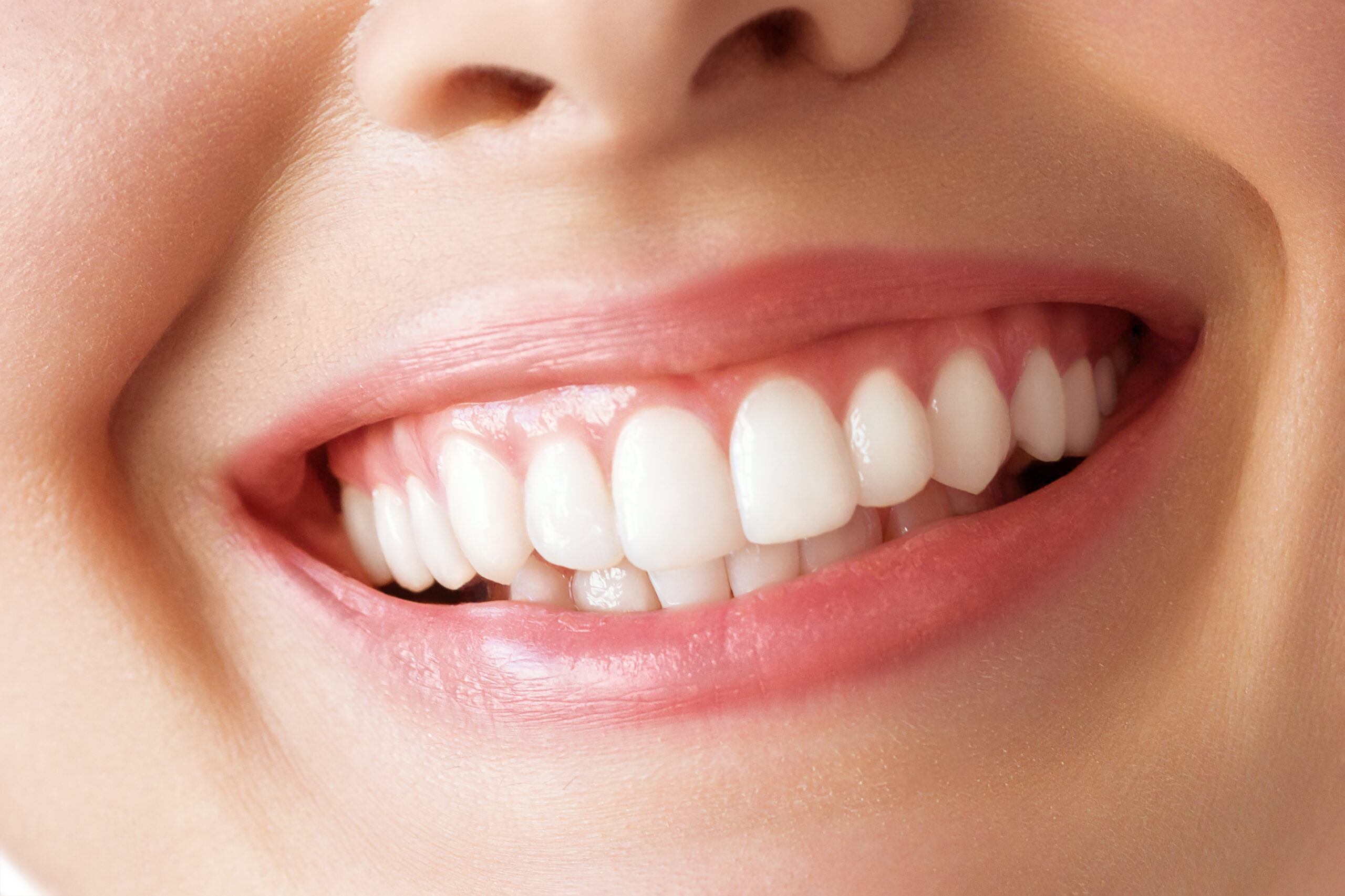 قص اللثة بالليزر في جدة: دليلك الكامل للابتسامة اللثوية وتجميل اللثة ابتسامة بأسنان مستقيمة وناصعة بعد علاج تجميلي للأسنان