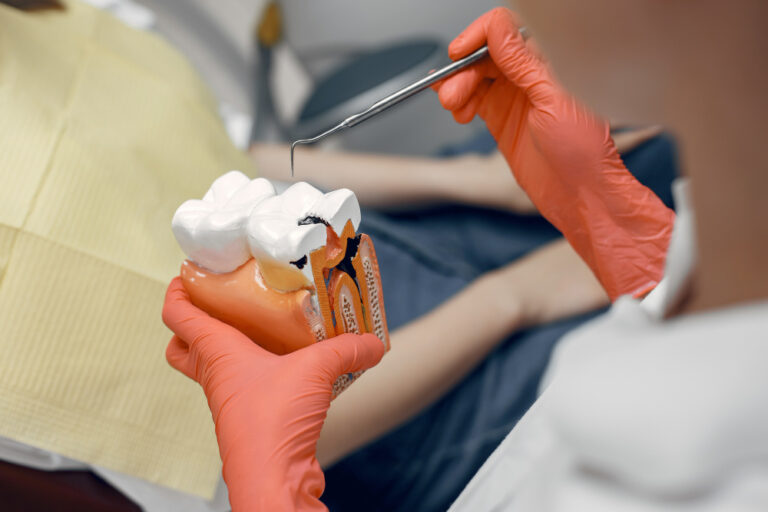 Broken lateral molar
