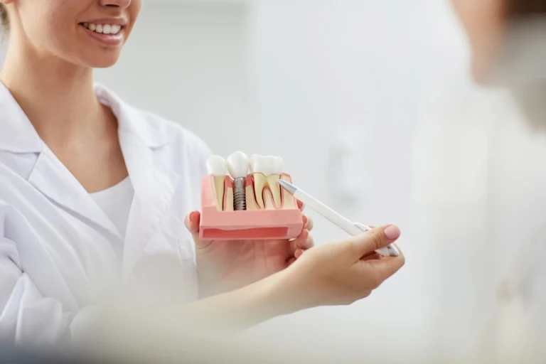 استشارة مريض حول زراعة الأسنان